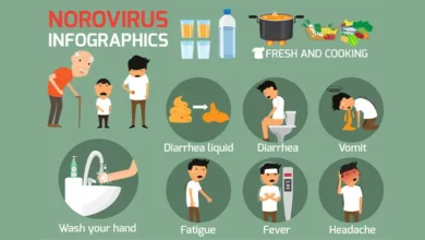 Norovirus: A Silent Epidemic in the United States